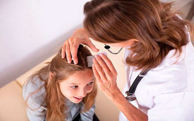 liečba psoriázy hlavy u detí