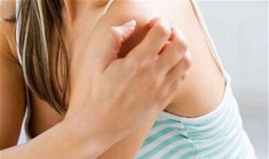 dievča sa škrabe na ramene